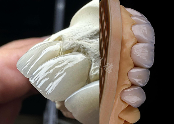 Giá tốt. Chứng răng lâu bền, vương miện Zirconia, răng chính xác, vương miện răng trực tuyến