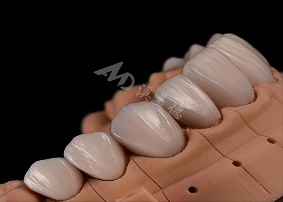 Giá tốt. Sức mạnh Vẻ đẹp tự nhiên Răng Circonia vương miện cho chính xác phù hợp chip kháng trực tuyến