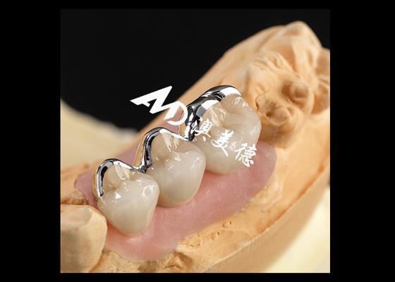Giá tốt. Gốm sứ PFM mạnh hợp nhất với vương miện kim loại Tương thích sinh học tuyệt vời Kháng mòn trực tuyến