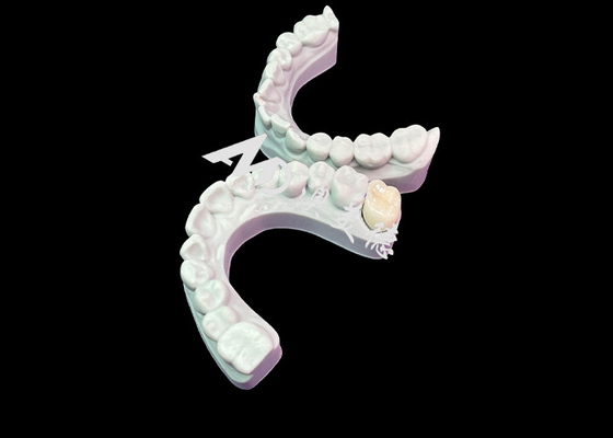 Giá tốt. Chọn chính xác Zirconia Vương miện răng sắc đẹp màu tự nhiên Tương thích sinh học tuyệt vời trực tuyến
