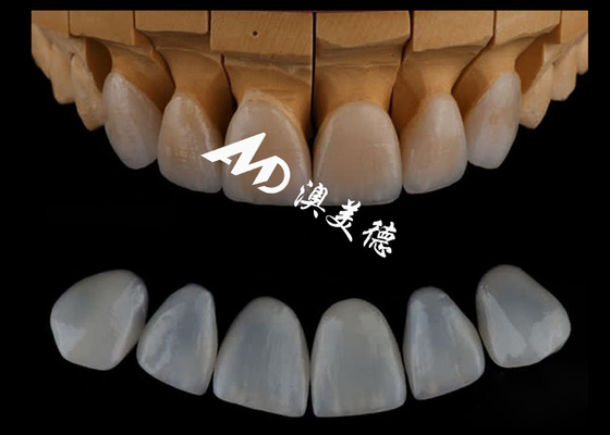 Giá tốt. Đơn vị hóa cao độ chính xác Emax Veneers / veneer nha khoa sứ cho nha khoa thẩm mỹ trực tuyến