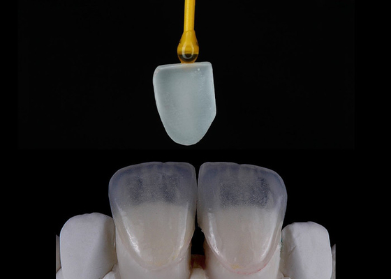 Giá tốt. Tự chế phục hồi răng EMAX Veneers Đặt hàng kỹ thuật số trực tuyến