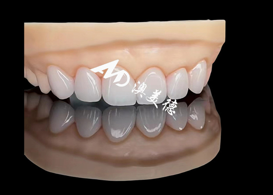 Giá tốt. Đồ xốp EMAX Veneer Cải tạo thẩm mỹ chính xác cao với độ bền vượt trội trực tuyến
