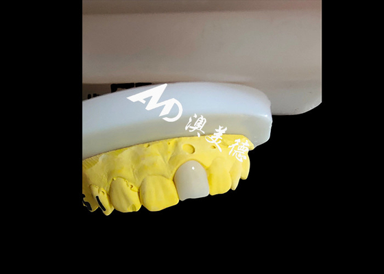 Giá tốt. Nhìn tự nhiên thẩm mỹ Zirconia Vương miện răng hoàn hảo phục hồi răng trực tuyến
