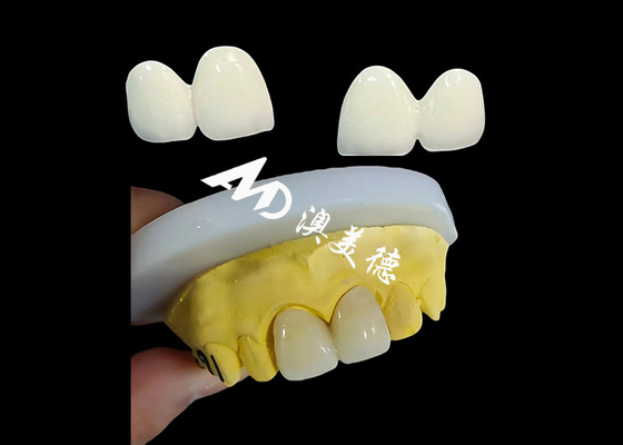 Giá tốt. Custom Zirconia Vương miện răng chính xác phù hợp Mũ răng từ Trung Quốc phòng thí nghiệm nha khoa trực tuyến