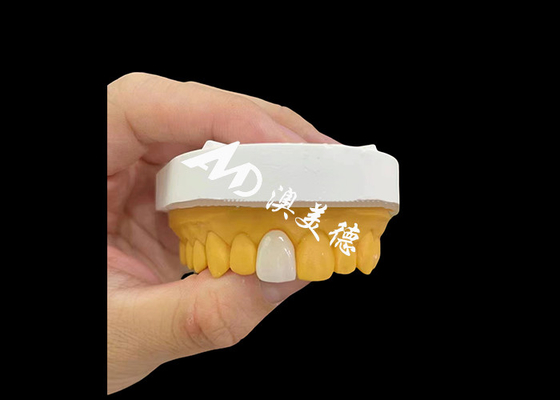 Giá tốt. Mặt cắt trước Zirconia Vương miện răng tự nhiên trông mạnh mẽ Kháng mòn trực tuyến