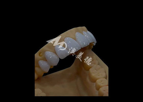 Giá tốt. Xương giả Nha khoa Zirconia Vương miện răng Đúng phù hợp với thẩm mỹ cho răng toàn vòm trực tuyến