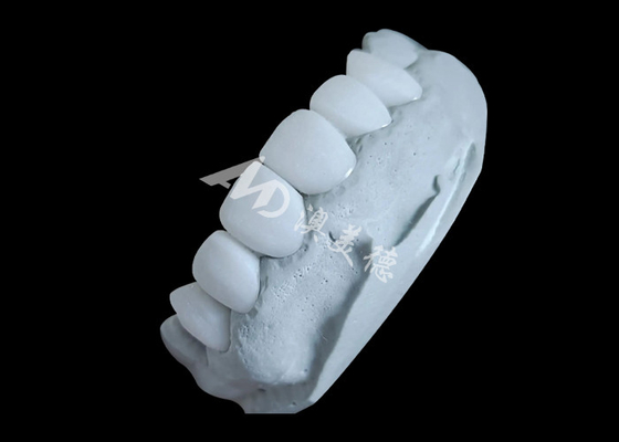 Giá tốt. Vương miện răng Zirconia mang lại sức mạnh không thể đánh bại và sự mịn màng tự nhiên, và độ mờ tự nhiên trực tuyến