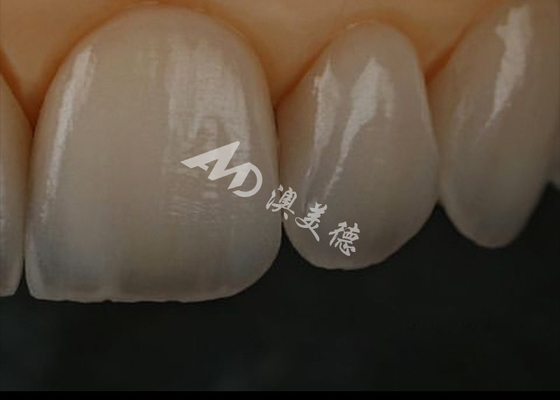 Giá tốt. Chống bị rạn nứt Zirconia Crown răng cho răng trước / răng sau trực tuyến