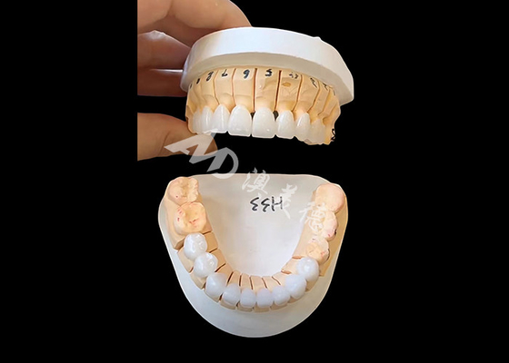 Giá tốt. Vương miện răng Zirconia xuyên suốt tăng cường cho phục hồi cố định đơn / đa đơn vị trực tuyến
