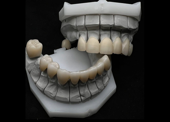 Giá tốt. Chống viền răng Zirconia Vương miện cho một hoặc nhiều răng trực tuyến