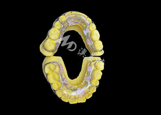 Giá tốt. Beagle Retainer để giữ lại nụ cười hiệu quả và sắp xếp lâu dài trực tuyến