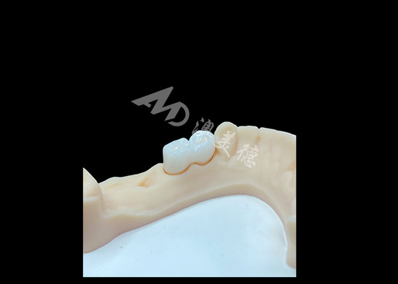 Giá tốt. Vương miện Zirconia rắn được đánh giá cao để phục hồi răng trực tuyến