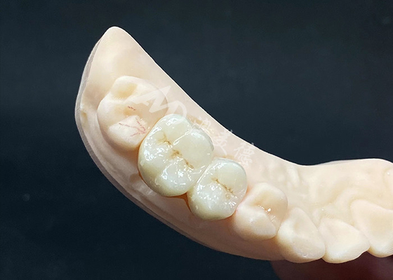 Giá tốt. Thiết kế trông tự nhiên với khả năng chống vỡ trực tuyến