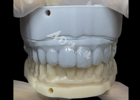 Giá tốt. Chế độ giữ răng chính trị Chế độ giữ răng Essix Đơn giản và linh hoạt trực tuyến