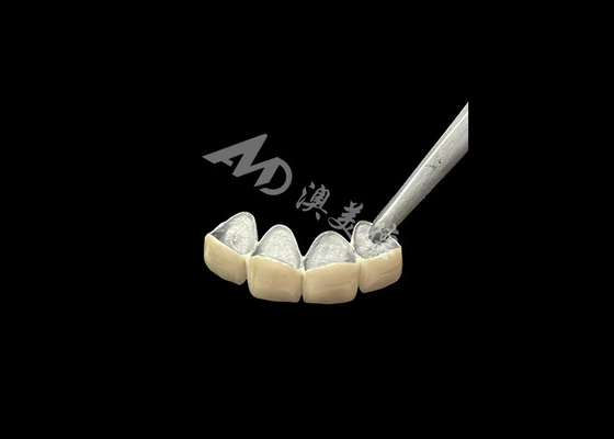 Giá tốt. Đồ xốp được hợp nhất với vương miện kim loại với khả năng chống ăn mòn cao hơn trực tuyến
