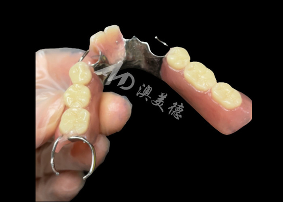 Giá tốt. Titanium đúc răng giả một phần với kẹp nằm cùng với răng được thiết lập trực tuyến