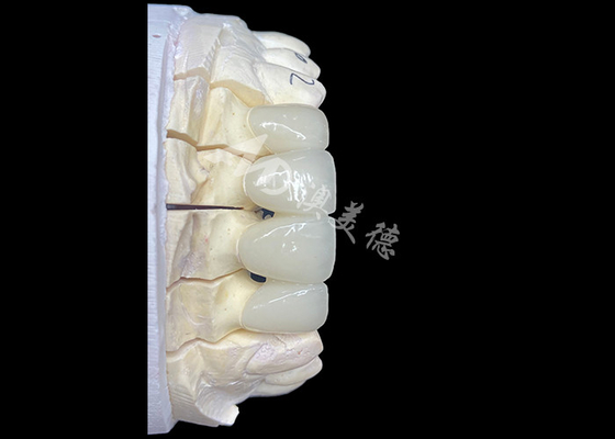 Giá tốt. Cây cầu vương miện gốm Zirconia trông tự nhiên cung cấp độ chính xác và thẩm mỹ kết hợp trực tuyến