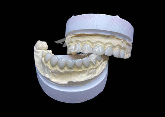 Giá tốt. Tùy chỉnh mặt dán sứ thủy tinh siêu mỏng độ trong suốt cao trực tuyến