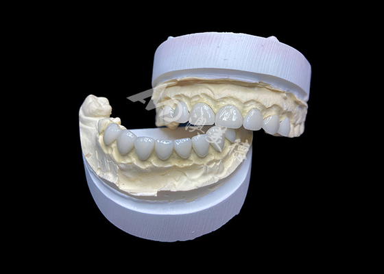 Giá tốt. Tùy chỉnh Ultra Thin Glass Ceramic Veneers Độ xuyên suốt cao cho nụ cười tự nhiên trực tuyến