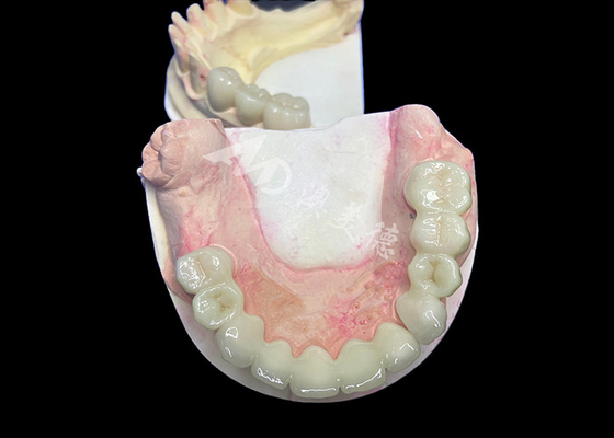 Giá tốt. Vàng Lava Zirconia trông tự nhiên với độ bền không thể sánh kịp Tương thích sinh học tuyệt vời trực tuyến