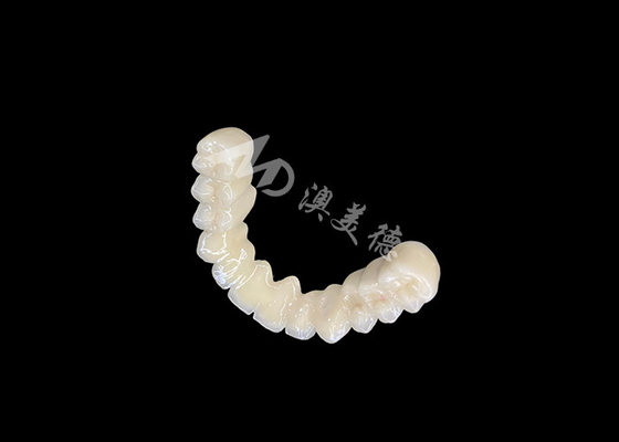 Giá tốt. Sắt răng lâu dài PFM Dental Crown Bridge với khả năng tương thích sinh học tuyệt vời trực tuyến