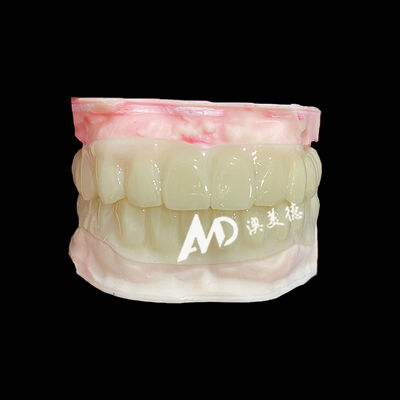 Giá tốt. PMMA Hollow Temporary Bridges for Implant Provisional Cases trực tuyến