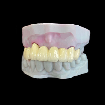 Giá tốt. Đồ xốp kim loại (PFM) vương miện với khung Co-Cr trực tuyến