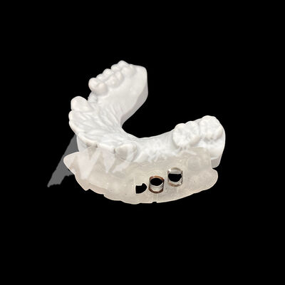 Giá tốt. Hướng dẫn cấy ghép phẫu thuật được in 3D chính xác phù hợp với khả năng chống đổi màu cao bằng công nghệ phay CAD/CAM trực tuyến