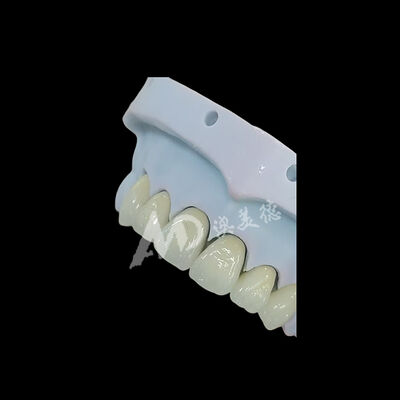 Giá tốt. Full Contour Monolithic Zirconia Vương miện răng Trực tuyến